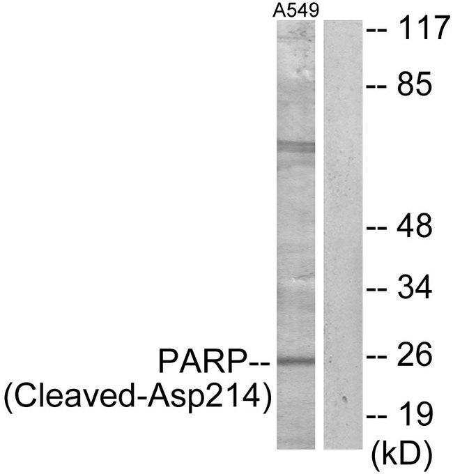 PARP1 Antibody - Western blot analysis of extracts from A549 cells, treated with etoposide (25uM, 24hours), using PARP (Cleaved-Asp214) antibody.