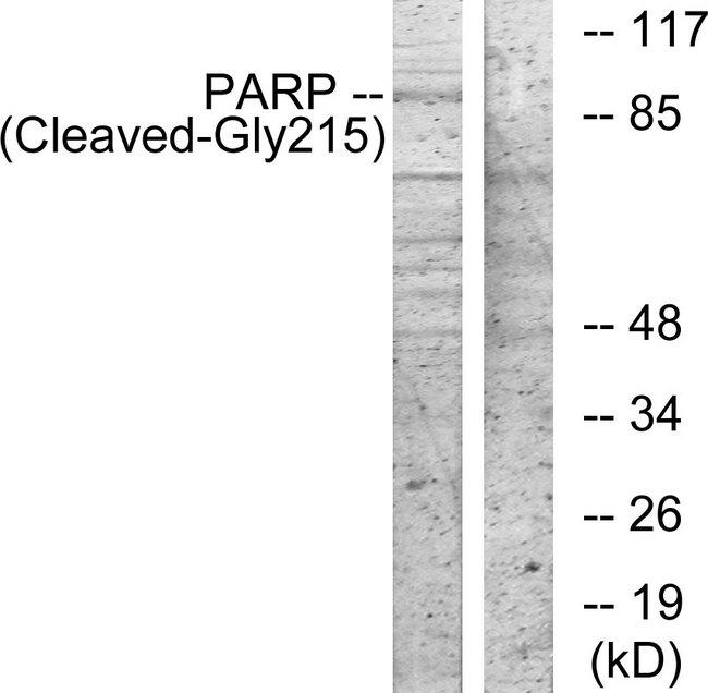 PARP1 Antibody - Western blot analysis of extracts from 3T3 cells, treated with etoposide (25uM, 1hour), using PARP (Cleaved-Gly215) antibody.