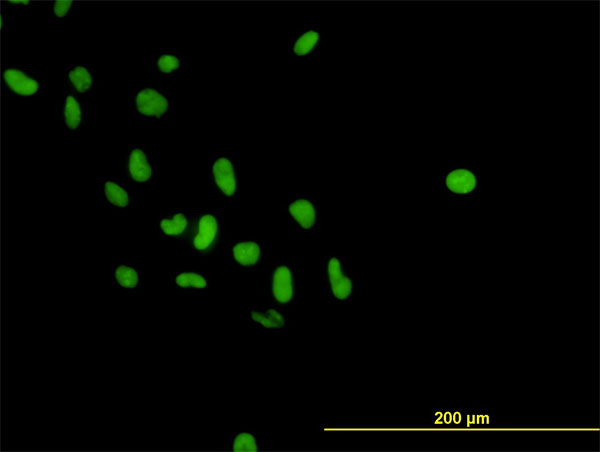 PARP1 Antibody - Immunofluorescence of monoclonal antibody to PARP1 on HeLa cell. [antibody concentration 10 ug/ml]