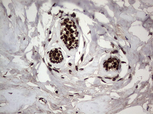 PARP1 Antibody - Immunohistochemical staining of paraffin-embedded Human breast tissue within the normal limits using anti-PARP1 mouse monoclonal antibody. (Heat-induced epitope retrieval by 1 mM EDTA in 10mM Tris, pH8.5, 120C for 3min,