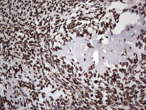 PARP1 Antibody - Immunohistochemical staining of paraffin-embedded Human Ovary tissue within the normal limits using anti-PARP1 mouse monoclonal antibody. (Heat-induced epitope retrieval by 1 mM EDTA in 10mM Tris, pH8.5, 120C for 3min,