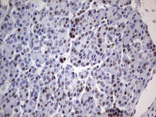 PARP1 Antibody - Immunohistochemical staining of paraffin-embedded Human pancreas tissue within the normal limits using anti-PARP1 mouse monoclonal antibody. (Heat-induced epitope retrieval by 1 mM EDTA in 10mM Tris, pH8.5, 120C for 3min,