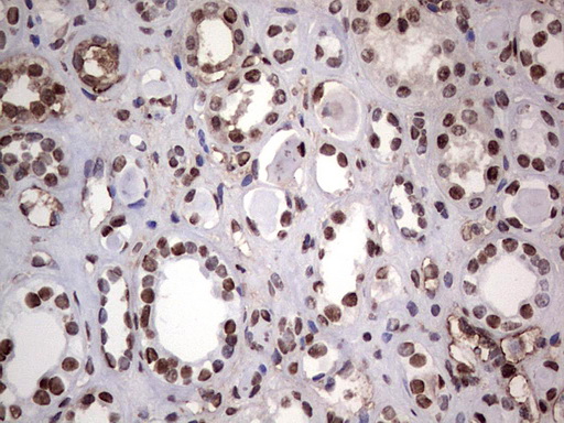 PARP1 Antibody - Immunohistochemical staining of paraffin-embedded Human Kidney tissue within the normal limits using anti-PARP1 mouse monoclonal antibody. (Heat-induced epitope retrieval by 1 mM EDTA in 10mM Tris, pH8.5, 120C for 3min,