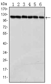 PARP1 Antibody - Western blot using PARP mouse monoclonal antibody against Jurkat (1), K562 (2), HeLa (3), Raji (4),THP-1 (5) and SW620 (6) cell lysate.