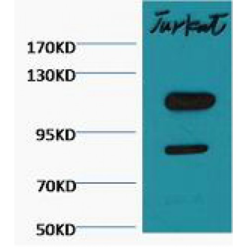 PARP1 Antibody - Western blot of Cleaved PARP antibody