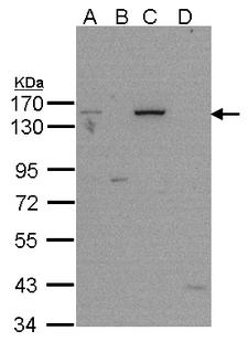 PARP1 Antibody - Sample (20 ug of 293T cell lysate). A: whole cell lysate. B: cytosol extract. C: nuclear extract. D: membrane extract. 7.5% SDS PAGE. PARP1 antibody diluted at 1:5000.