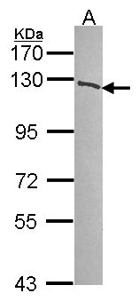 PARP1 Antibody - Sample (30 ug of whole cell lysate). A: A549. 7.5% SDS PAGE. PARP1 antibody. PARP1 antibody diluted at 1:1000. 