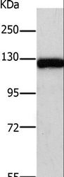 PARP1 Antibody - Western blot analysis of Human fetal brain tissue, using PARP1 Polyclonal Antibody at dilution of 1:500.