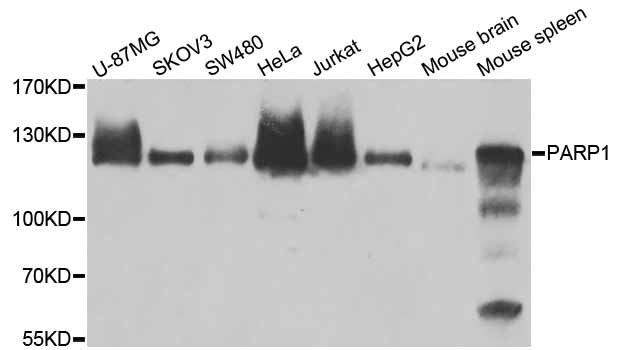 PARP1 Antibody - Western blot analysis of extracts of various cell lines.