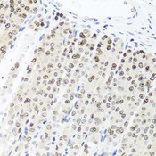 PARP1 Antibody - Immunohistochemistry of paraffin-embedded mouse stomach tissue.