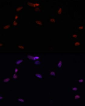 PARP1 Antibody - Immunofluorescence analysis of U2OS cells using PARP1 antibodyat dilution of 1:100. Blue: DAPI for nuclear staining.