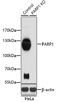 PARP1 Antibody - Western blot analysis of extracts from normal (control) and PARP1 knockout (KO) HeLa cells, using PARP1 antibodyat 1:1000 dilution. The secondary antibody used was an HRP Goat Anti-Rabbit IgG (H+L) at 1:10000 dilution. Lysates were loaded 25ug per lane and 3% nonfat dry milk in TBST was used for blocking. An ECL Kit was used for detection and the exposure time was 90s.