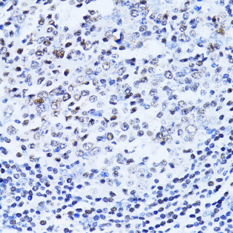 PARP1 Antibody - Immunohistochemistry of paraffin-embedded human vermiform appendix using PARP1 Antibodyat dilution of 1:100 (40x lens).