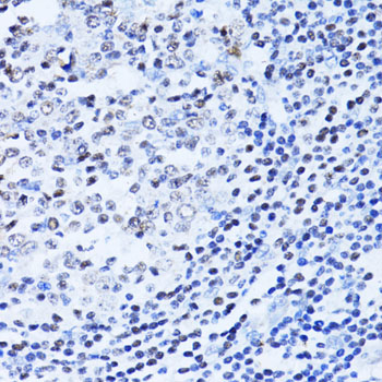 PARP1 Antibody - Immunohistochemistry of paraffin-embedded human appendix using PARP1 antibodyat dilution of 1:100 (40x lens).
