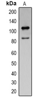 PARP1 Antibody - Western blot analysis of Cleaved PARP1 expression in Jurkat (A) whole cell lysates.