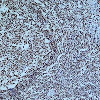 PARP1 Antibody - Immunohistochemical analysis of Cleaved PARP1 staining in human tonsil formalin fixed paraffin embedded tissue section. The section was pre-treated using heat mediated antigen retrieval with sodium citrate buffer (pH 6.0). The section was then incubated with the antibody at room temperature and detected using an HRP conjugated compact polymer system. DAB was used as the chromogen. The section was then counterstained with hematoxylin and mounted with DPX.