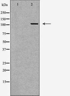 PARP1 Antibody - Western blot analysis of HeLa whole cells lysates using PARP1 antibody. The lane on the left is treated with the antigen-specific peptide.