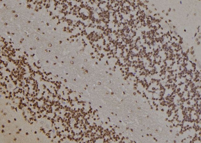 PARP1 Antibody - 1:100 staining rat brain tissue by IHC-P. The sample was formaldehyde fixed and a heat mediated antigen retrieval step in citrate buffer was performed. The sample was then blocked and incubated with the antibody for 1.5 hours at 22°C. An HRP conjugated goat anti-rabbit antibody was used as the secondary.