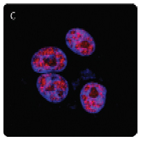 PARP1 Antibody - Hela cells were stained with PE anti-PARP antibody and DAPI. The image shows nuclear localization of PARP.