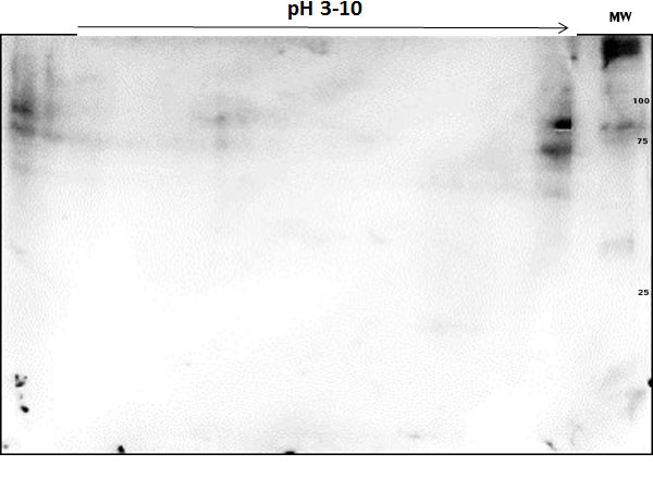 PARP1 Antibody - OVCAR-8 Wild Type Lysate was separated on 2D SDS-PAGE and blotted on PVDF to analyze immunocoverage of PARP1 antibody specific for the zinc finger 1 domain of PARP1. Primary Antibody: Anti-PARP1 (n-term) antibody 1:200 overnight at 4°C. Secondary Antibody: Goat anti-rabbit Peroxidase at 1:2,000 at RT for 30min. Blocking Buffer: BlockOut for 30 min at RT. Predicted/observed: ~110 kDa and pI 9.7.