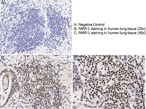 PARP1 Antibody - Immunohistochemistry with anti-PARP-1 antibody showing nuclear positivity in human lung tissue at 20x and 40x (B & C). Staining was performed on Leica Bond system using the standard protocol. Formalin fixed/paraffin embedded tissue sections were subjected to antigen retrieval and then incubated with rabbit anti-PARP-1 antibody at 1:100 dilution for 60 minutes. Biotinylated Anti-rabbit secondary antibody was used at 1:200 dilution to detect primary antibody. The reaction was developed using streptavidin-HRP conjugated compact polymer system and visualized with chromogen substrate, 3?-diamino-benzidine substrate (DAB). The sections were then counterstained with hematoxylin to detect cell nuclei.