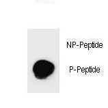 PARP1 Antibody - Dot blot of Phospho-PARP1-S782 Antibody Phospho-specific antibody on nitrocellulose membrane. 50ng of Phospho-peptide or Non Phospho-peptide per dot were adsorbed. Antibody working concentrations are 0.6ug per ml.