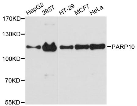 PARP10 Antibody - Western blot analysis of extracts of various cell lines, using PARP10 antibody at 1:3000 dilution. The secondary antibody used was an HRP Goat Anti-Rabbit IgG (H+L) at 1:10000 dilution. Lysates were loaded 25ug per lane and 3% nonfat dry milk in TBST was used for blocking. An ECL Kit was used for detection and the exposure time was 90s.