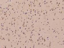 PARP10 Antibody - Immunochemical staining of human PARP10 in human brain with rabbit polyclonal antibody at 1:100 dilution, formalin-fixed paraffin embedded sections.