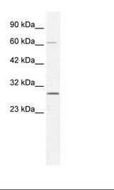 PARP11 Antibody - HepG2 Cell Lysate.  This image was taken for the unconjugated form of this product. Other forms have not been tested.