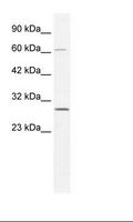 PARP11 Antibody - HepG2 Cell Lysate.  This image was taken for the unconjugated form of this product. Other forms have not been tested.