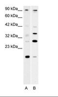 PARP11 Antibody - A. Fetal Muscle Lysate, B. Fetal Lung Lysate.  This image was taken for the unconjugated form of this product. Other forms have not been tested.
