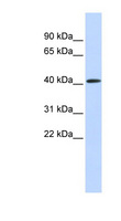 PARP11 Antibody - PARP11 antibody Western blot of Fetal Muscle lysate. This image was taken for the unconjugated form of this product. Other forms have not been tested.
