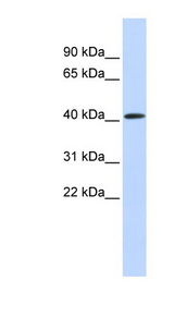 PARP11 Antibody - PARP11 antibody Western blot of Fetal Muscle lysate. This image was taken for the unconjugated form of this product. Other forms have not been tested.