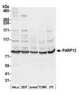PARP12 Antibody - Detection of human and mouse PARP12 by western blot. Samples: Whole cell lysate (50 µg) from HeLa, HEK293T, Jurkat, mouse TCMK-1, and mouse NIH 3T3 cells prepared using NETN lysis buffer. Antibody: Affinity purified rabbit anti-PARP12 antibody used for WB at 0.1 µg/ml. Detection: Chemiluminescence with an exposure time of 1 second.