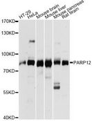 PARP12 Antibody - Western blot analysis of extracts of various cell lines, using PARP12 antibody at 1:3000 dilution. The secondary antibody used was an HRP Goat Anti-Rabbit IgG (H+L) at 1:10000 dilution. Lysates were loaded 25ug per lane and 3% nonfat dry milk in TBST was used for blocking. An ECL Kit was used for detection and the exposure time was 10s.