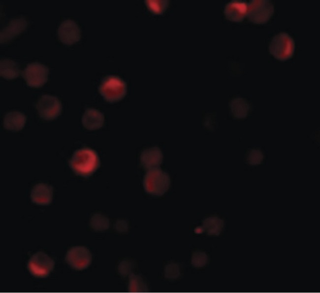 PARP13 / ZC3HAV1 Antibody - Immunofluorescence of ZC3HAV1 in HeLa cells with ZC3HAV1 antibody at 20 ug/ml.