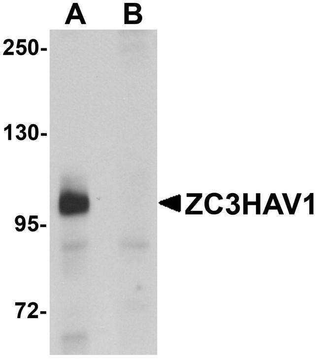 PARP13 / ZC3HAV1 Antibody - Western blot analysis of ZC3HAV1 in HeLa cell lysate with ZC3HAV1 antibody at 1ug/ml in (A) the absence and (B) the presence of blocking peptide.