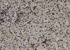 PARP13 / ZC3HAV1 Antibody - 1:100 staining human liver tissue by IHC-P. The sample was formaldehyde fixed and a heat mediated antigen retrieval step in citrate buffer was performed. The sample was then blocked and incubated with the antibody for 1.5 hours at 22°C. An HRP conjugated goat anti-rabbit antibody was used as the secondary.