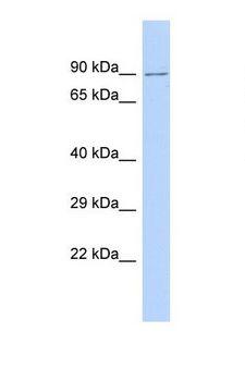 PARP14 Antibody - Western blot of Human 721_B. PARP14 antibody dilution 1.0 ug/ml.  This image was taken for the unconjugated form of this product. Other forms have not been tested.