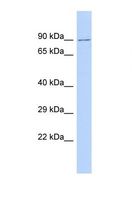 PARP14 Antibody - Western blot of Human 721_B. PARP14 antibody dilution 1.0 ug/ml.  This image was taken for the unconjugated form of this product. Other forms have not been tested.