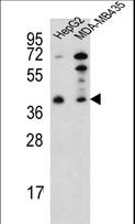 PARP16 Antibody - Western blot of PARP16 Antibody in HepG2,MDA-MB435 cell line lysates (35 ug/lane). PARP16 (arrow) was detected using the purified antibody.