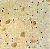 PARP16 Antibody - PARP16 Antibody IHC of formalin-fixed and paraffin-embedded human brain tissue followed by peroxidase-conjugated secondary antibody and DAB staining.