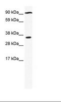 PARP16 Antibody - Fetal kidney Lysate.  This image was taken for the unconjugated form of this product. Other forms have not been tested.