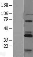 PARP16 Protein - Western validation with an anti-DDK antibody * L: Control HEK293 lysate R: Over-expression lysate