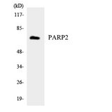 PARP2 Antibody - Western blot analysis of the lysates from HeLa cells using PARP2 antibody.
