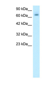 PARP2 Antibody - PARP2 antibody Western blot of Raji lysate. This image was taken for the unconjugated form of this product. Other forms have not been tested.