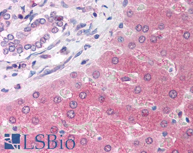 PARP2 Antibody - Anti-PARP2 antibody IHC of human liver. Immunohistochemistry of formalin-fixed, paraffin-embedded tissue after heat-induced antigen retrieval. Antibody concentration 5 ug/ml.  This image was taken for the unconjugated form of this product. Other forms have not been tested.
