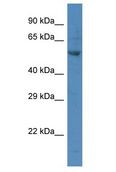 PARP2 Antibody - PARP2 antibody Western Blot of MCF7. Antibody dilution: 1 ug/ml.  This image was taken for the unconjugated form of this product. Other forms have not been tested.