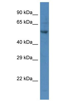 PARP2 Antibody - PARP2 antibody Western Blot of MCF7. Antibody dilution: 1 ug/ml.  This image was taken for the unconjugated form of this product. Other forms have not been tested.