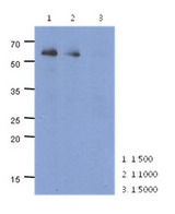PARP2 Antibody - Western Blot: The cell lysate of HeLa (40 ug) were resolved by SDS-PAGE, transferred to PVDF membrane and probed with anti-human PARP2 antibody (1:500 ~ 1:5000). Proteins were visualized using a goat anti-mouse secondary antibody conjugated to HRP and an ECL detection system.